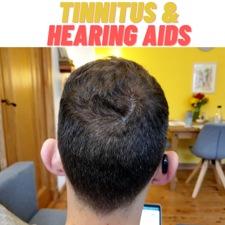 Read more about the article Tinnitus & Hearing Aids